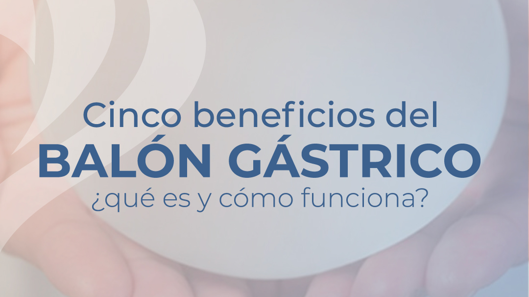 5 beneficios del balón intragástrico