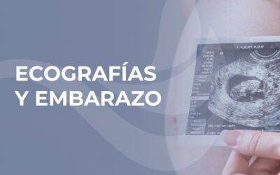 Lo que debes saber sobre las ecografías durante el embarazo