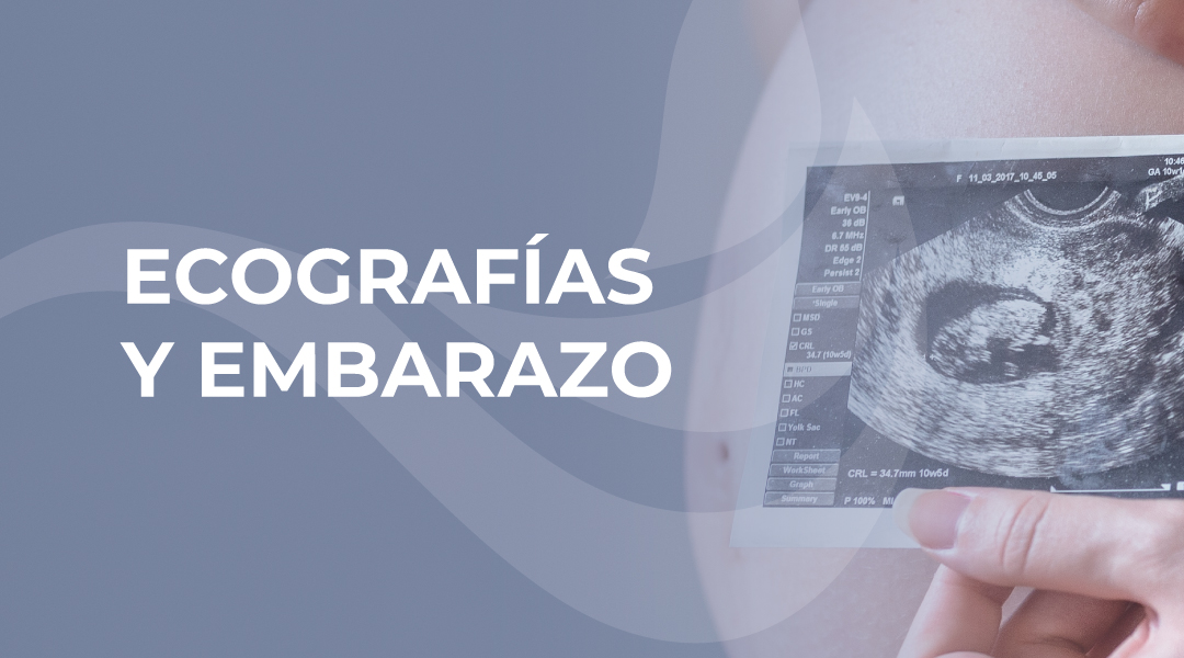 Lo que debes saber sobre las ecografías durante el embarazo