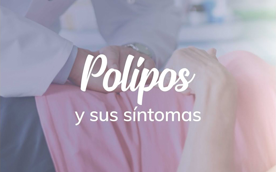 Todo lo que necesitas saber sobre los polipos.