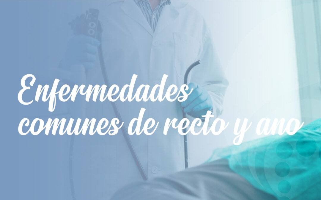 Enfermedades del recto y ano