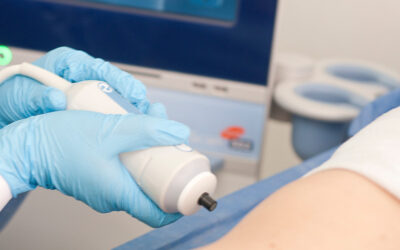 ¿A qué pacientes se les realiza la prueba de Fibroscan?
